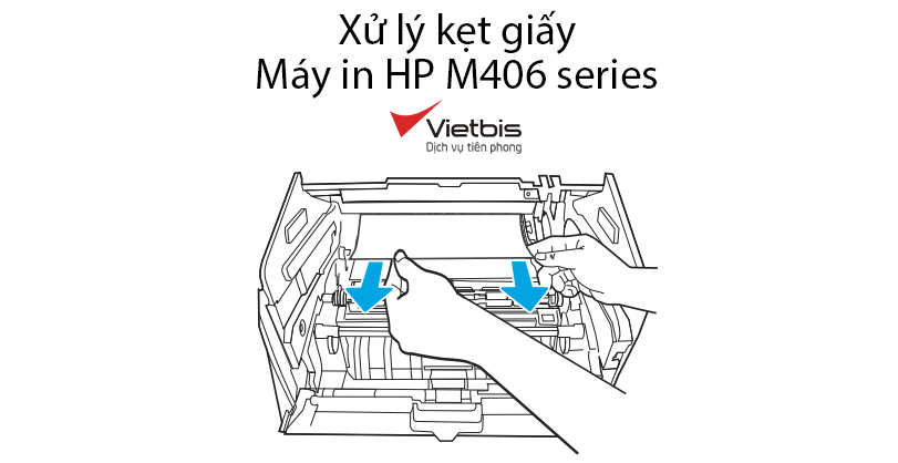 Xử lý kẹt giấy máy in HP M406 series